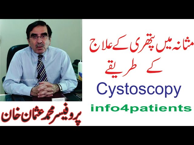 Best Urologist | Bladder Stone Cystoscopy | Doctor Mohammad Usman Khan